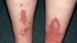 Tagatose: Mystery 6 Gula Alami Rendah Kalori